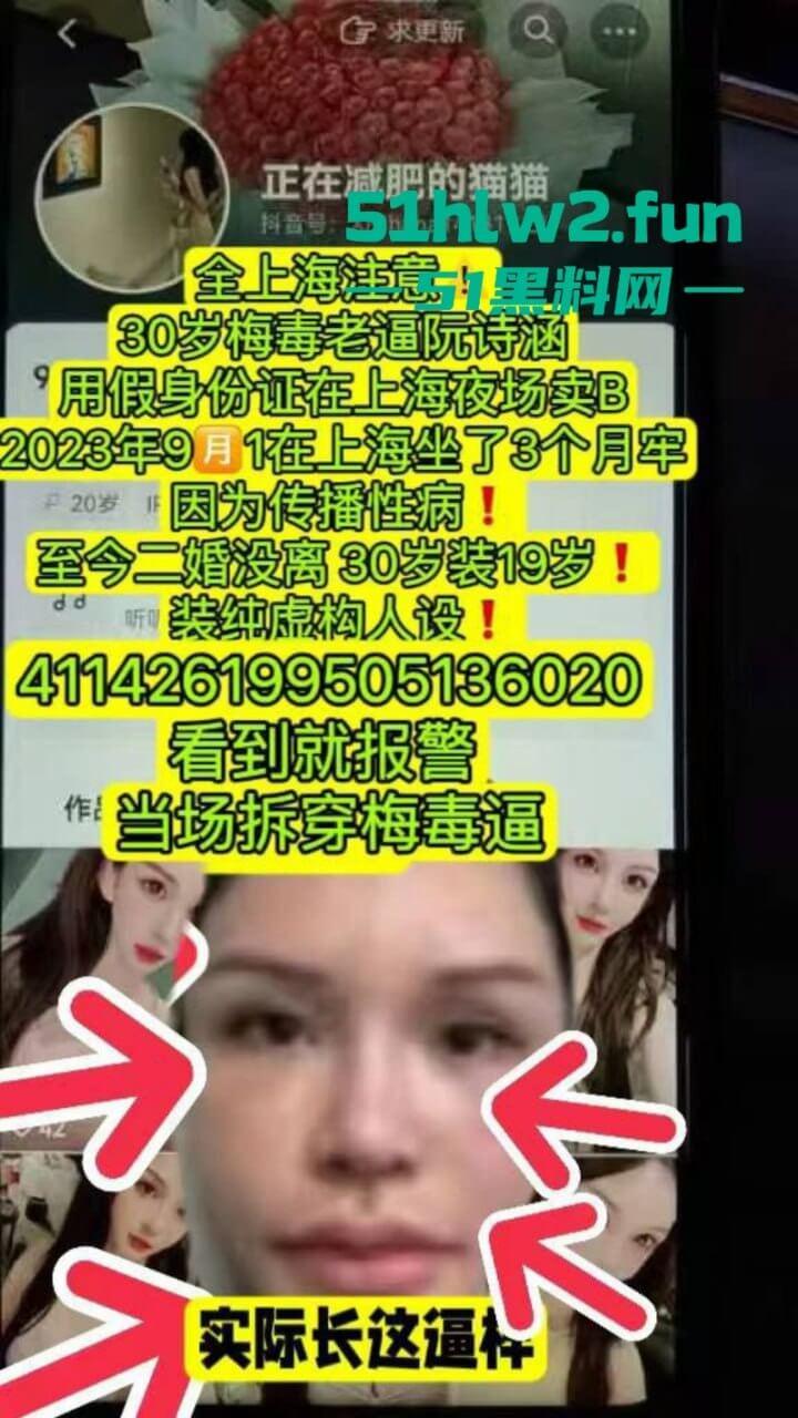 夜场梅毒女【阮诗涵】装嫩卖逼传毒坑害多人,仍在抖音撒网捕鱼专骗老实人全网避雷!-1
