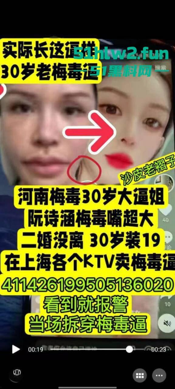 夜场梅毒女【阮诗涵】装嫩卖逼传毒坑害多人,仍在抖音撒网捕鱼专骗老实人全网避雷!-3