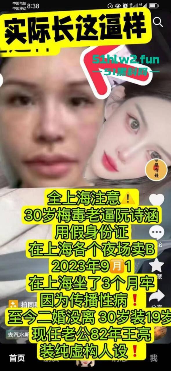 夜场梅毒女【阮诗涵】装嫩卖逼传毒坑害多人,仍在抖音撒网捕鱼专骗老实人全网避雷!-4