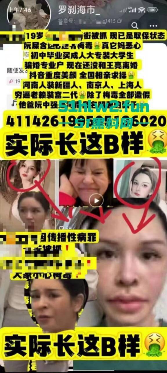 夜场梅毒女【阮诗涵】装嫩卖逼传毒坑害多人,仍在抖音撒网捕鱼专骗老实人全网避雷!-7