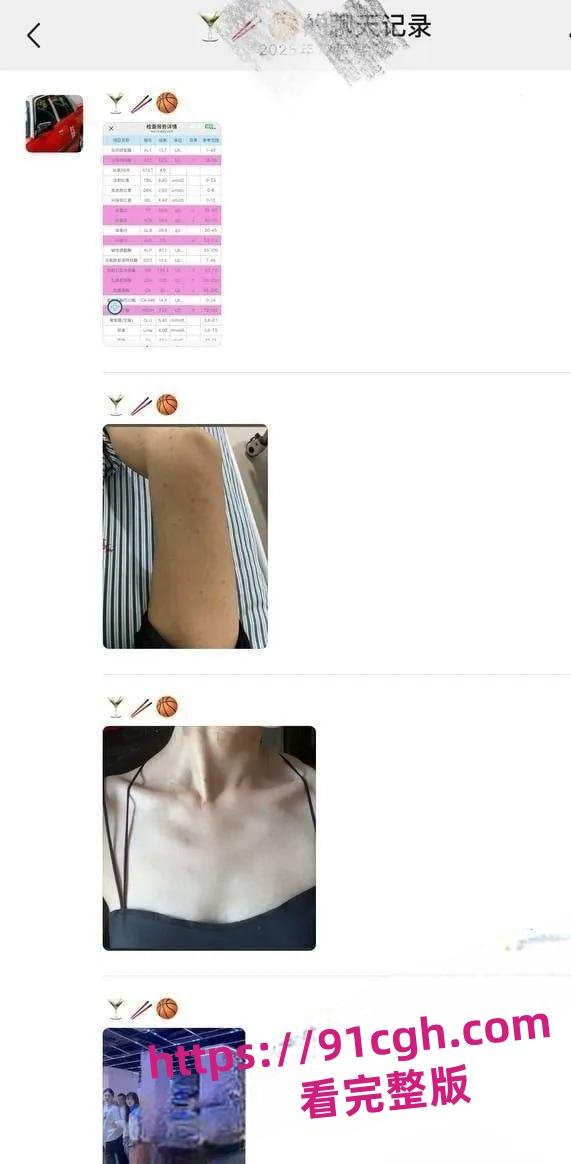 抖音女网红 轮滑冰姑娘 被曝竟是生化母体 携带艾滋卖淫感染超千人-8