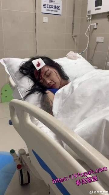 闺蜜当场破防持刀自残！一句“我有你出轨视频”引爆惊天大瓜-6